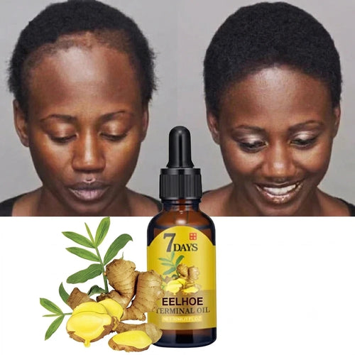 Ginger Hair Growth Serum